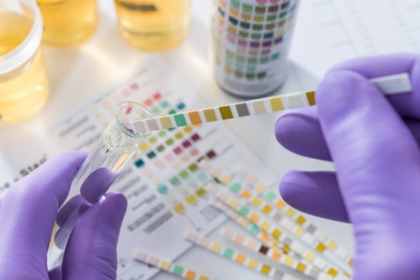 Proposed Unemployment Drug-Testing Rule Set To Be Finalized