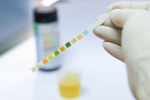 Fentanyl Test Strips: Important Tool Or False Security?