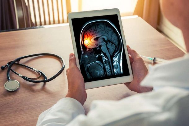 Experimental Brain Implant To Curb Addiction Being Tested In China